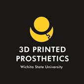 3D Printed Prosthetics