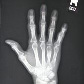 Lcsc Radiography - Palm Beach State College